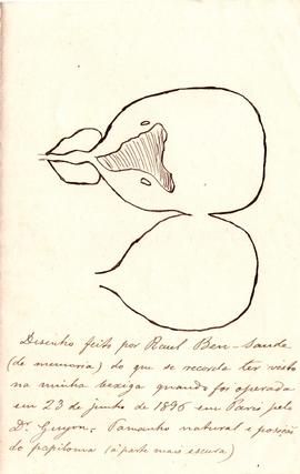 Desenho da bexiga